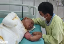 Cú phóng điện cao thế khiến người đàn ông mất đôi tay, nguy kịch tính mạng