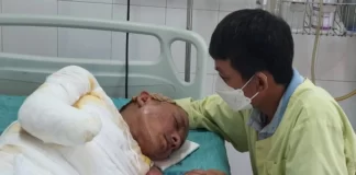 Cú phóng điện cao thế khiến người đàn ông mất đôi tay, nguy kịch tính mạng