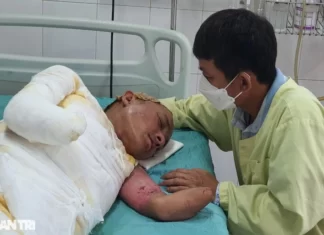Cú phóng điện cao thế khiến người đàn ông mất đôi tay, nguy kịch tính mạng
